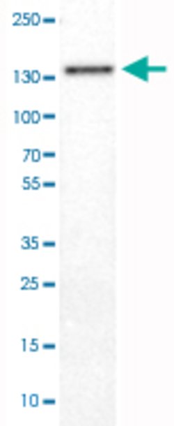 DIAPH2, Mouse anti-Human, Clone: CL1111, Abnova 100&mu;L; Unconjugated:Antibodies,