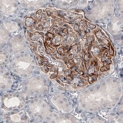 THSD7A, Mouse anti-Human, Clone: CL3778, Abnova 100 &mu;L | Buy Online | Abnova | Fisher Scientific