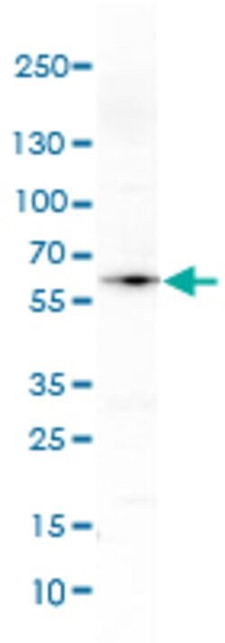 RBCK1, Mouse anti-Human, Clone: CL4289, Abnova 100 &mu;L | Buy Online | Abnova | Fisher Scientific