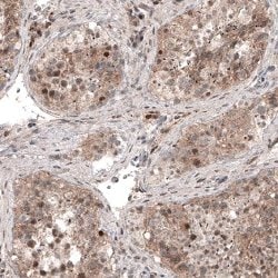 USP30, Mouse anti-Human, Clone: CL4438, Abnova 100&mu;L; Unconjugated:Antibodies,