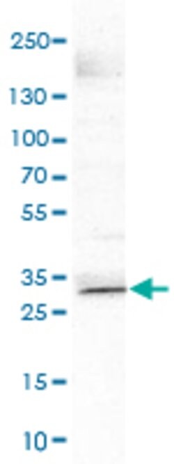 SOX21, Mouse anti-Human, Clone: CL4681, Abnova 100 &mu;L | Buy Online | Abnova | Fisher Scientific
