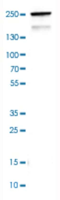 MYH6, Mouse anti-Human, Clone: CL2162, Abnova 100&mu;L; Unconjugated:Antibodies,