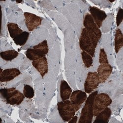 MYH6, Mouse anti-Human, Clone: CL2162, Abnova 100&mu;L; Unconjugated:Antibodies,