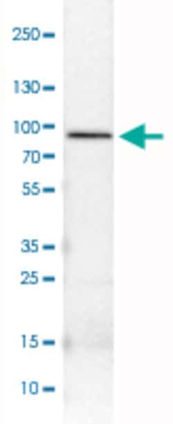 CARS, Mouse anti-Human, Clone: CL2304, Abnova 100&mu;L; Unconjugated:Antibodies,