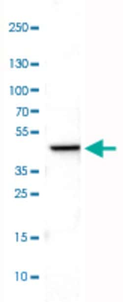 CS, Mouse anti-Human, Clone: CL2545, Abnova 100&mu;L; Unconjugated:Antibodies,