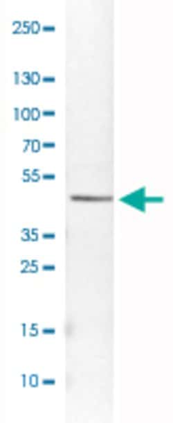CS, Mouse anti-Human, Clone: CL2561, Abnova 100&mu;L; Unconjugated:Antibodies,