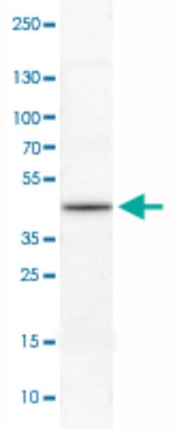 HNRNPC, Mouse anti-Human, Clone: CL2596, Abnova 100&mu;L; Unconjugated:Antibodies,
