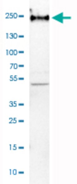 NEFH, Mouse anti-Human, Clone: CL2671, Abnova 100 &mu;L | Buy Online | Abnova | Fisher Scientific