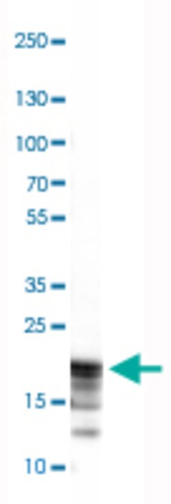 MBP, Mouse anti-Human, Clone: CL2819, Abnova 100&mu;L; Unconjugated:Antibodies,