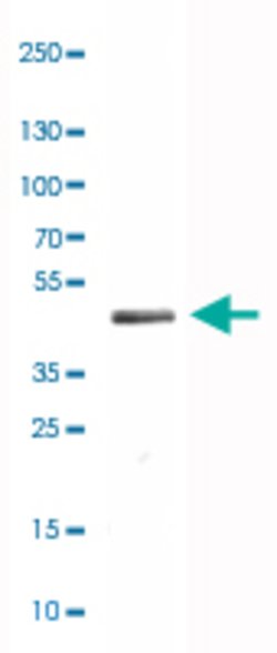CNP, Mouse anti-Human, Clone: CL2871, Abnova 100&mu;L; Unconjugated:Antibodies,