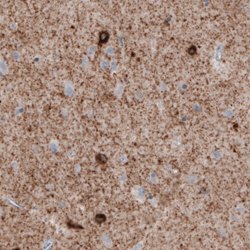 GAD1, Mouse anti-Human, Clone: CL2911, Abnova 100&mu;L; Unconjugated:Antibodies,