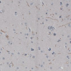 TPH2, Mouse anti-Human, Clone: CL2990, Abnova 100 &mu;L | Buy Online | Abnova | Fisher Scientific