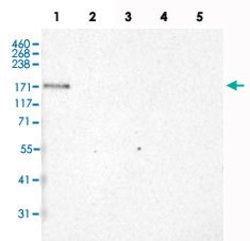 LAMA3, Mouse anti-Human, Clone: CL3112, Abnova 100 &mu;L | Buy Online | Abnova | Fisher Scientific