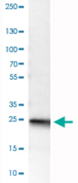 UCHL1, Mouse anti-Human, Clone: CL3210, Abnova 100&mu;L; Unconjugated:Antibodies,