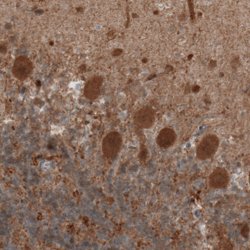 UCHL1, Mouse anti-Human, Clone: CL3210, Abnova 100&mu;L; Unconjugated:Antibodies,