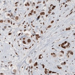 ARID1A, Mouse anti-Human, Clone: CL3595, Abnova 100&mu;L; Unconjugated:Antibodies,