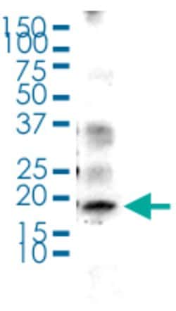 Histone H2B (K123ub) monoclonal antibody, Abnova 50&mu;g; Unconjugated:Antibodies,