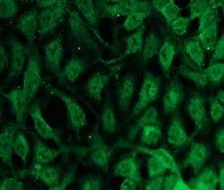 PRKCB, Rabbit anti-Human, Clone: N11-S, Abnova 100&mu;L; Unconjugated:Antibodies,