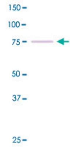 PRKCE, Rabbit anti-Human, Clone: G13-X, Abnova 100&mu;L; Unconjugated:Antibodies,