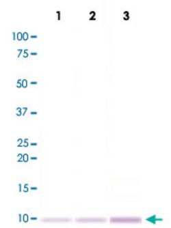 MT1A, Rabbit anti-Human, Clone: N11-G, Abnova 100&mu;L; Unconjugated:Antibodies,