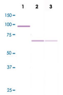 PRKCZ, Rabbit anti-Human, Clone: R14-K, Abnova 50 &mu;L | Buy Online | Abnova | Fisher Scientific