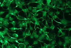 PRKCZ, Rabbit anti-Human, Clone: R14-K, Abnova 50 &mu;L | Buy Online | Abnova | Fisher Scientific