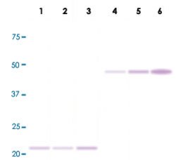 BAX, Rabbit anti-Human, Clone: G26-R, Abnova 50&mu;L; Unconjugated:Antibodies,