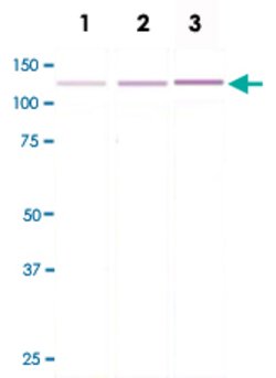TP63, Rabbit anti-Human, Clone: C24-I, Abnova 50&mu;L; Unconjugated:Antibodies,