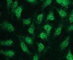 MAPK11, Rabbit anti-Human, Clone: E13-Q, Abnova 50&mu;L; Unconjugated:Antibodies,