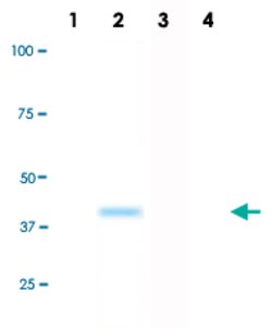 MAPK11, Rabbit anti-Human, Clone: E13-Q, Abnova 50&mu;L; Unconjugated:Antibodies,