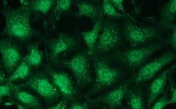 MAPK12, Rabbit anti-Human, Clone: R13-L, Abnova 50&mu;L; Unconjugated:Antibodies,