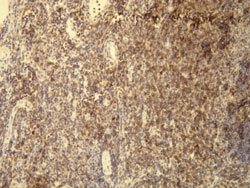 CD5, Rabbit anti-Human, Clone: A25-G, Abnova 200&mu;L; Unconjugated:Antibodies,