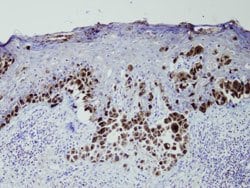 SILV, Rabbit anti-Human, Clone: P14-V, Abnova 200&mu;L; Unconjugated:Antibodies,