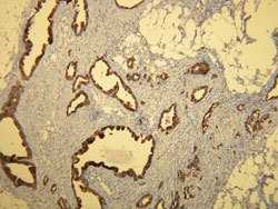 KRT7, Rabbit anti-Human, Clone: R17-S, Abnova 200&mu;L; Unconjugated:Antibodies,
