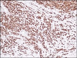 ESR1, Rabbit anti-Human, Clone: S21-V, Abnova 200&mu;L; Unconjugated:Antibodies,