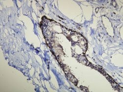 KRT14, Rabbit anti-Human, Clone: D19-N, Abnova 200&mu;L; Unconjugated:Antibodies,