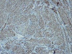 DES, Rabbit anti-Human, Clone: E18-V, Abnova 100&mu;L; Unconjugated:Antibodies,