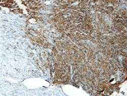 CD34, Rabbit anti-Human, Clone: Q19-E, Abnova 100&mu;L; Unconjugated:Antibodies,
