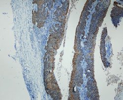 CDKN2A, Rabbit anti-Human, Clone: R19-D, Abnova 100&mu;L; Unconjugated:Antibodies,