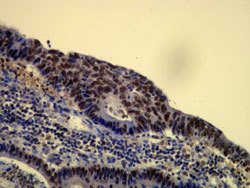 CHAF1B, Rabbit anti-Human, Clone: E17-L, Abnova 100&mu;L; Unconjugated:Antibodies,