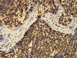 B3GAT1, Rabbit anti-Human, Clone: E20-I, Abnova 100&mu;L; Unconjugated:Antibodies,