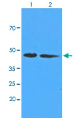 ADK, Mouse anti-Human, Clone: AT4F8, Abnova 50&mu;L; Unconjugated:Antibodies,