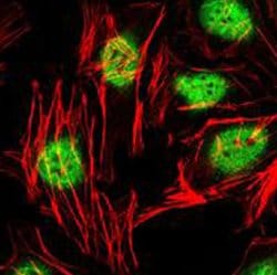 ZBTB16, Mouse anti-Human, Clone: 5B3, Abnova 50&mu;L; Unconjugated:Antibodies,