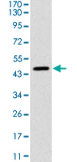 YAP1, Mouse anti-Human, Clone: 1A12, Abnova 50&mu;g; Unconjugated:Antibodies,