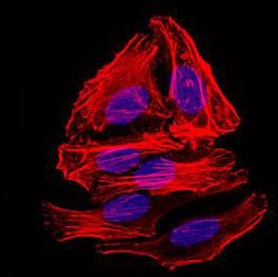 Psp, Mouse anti-Mouse, Clone: 1F12, Abnova 50&mu;g; Unconjugated:Antibodies,