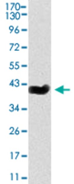 Psp, Mouse anti-Mouse, Clone: 1F12, Abnova 50&mu;g; Unconjugated:Antibodies,
