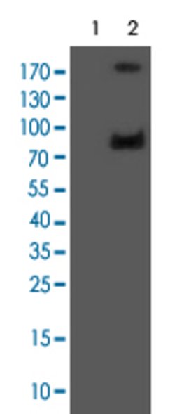 GLB1, Mouse anti-Human, Clone: 5H2, Abnova 50&mu;L; Unconjugated:Antibodies,