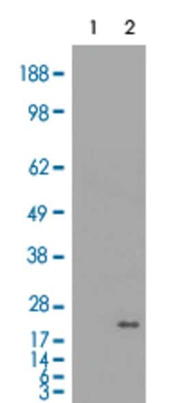CRYAB, Mouse anti-Human, Clone: 6D11, Abnova 50&mu;L; Unconjugated:Antibodies,
