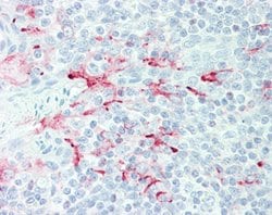 MSLN, Mouse anti-Human, Clone: MN-1, Abnova 50 &mu;g | Buy Online | Abnova Corporation | Fisher Scientific