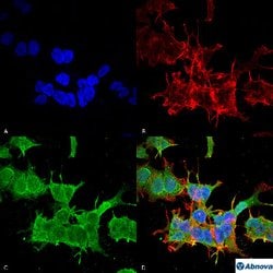 SPTBN4, Mouse anti-Human, Biotin, Clone: S393-2, Abnova 100&mu;g; Biotin:Antibodies,